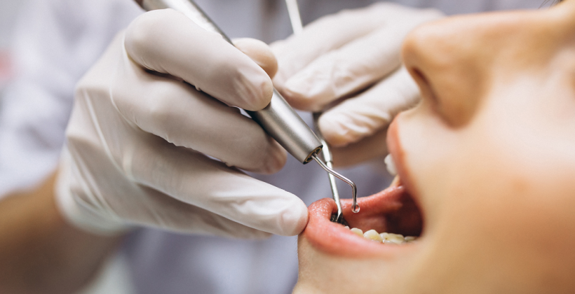 Odontoiatria conservativa: funzionalità ed estetica per i denti danneggiati