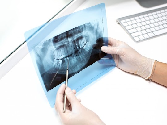 Cisti dentali: sintomi e trattamenti