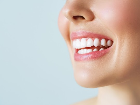 Faccette dentali: cosa sono e quali sono i vantaggi?