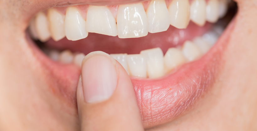 Come gestire i traumi dentali?