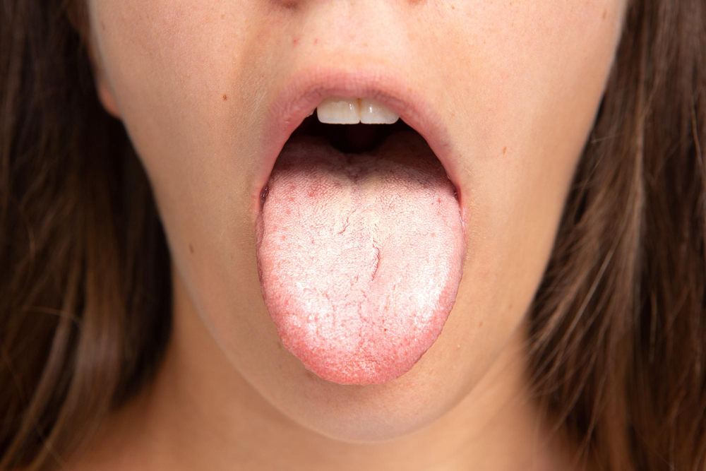 Cosa Mangiare Dopo Impianto Dentale Impianto dentale: cosa mangiare? - Dott. Matteo Zappa - Medico Chirurgo