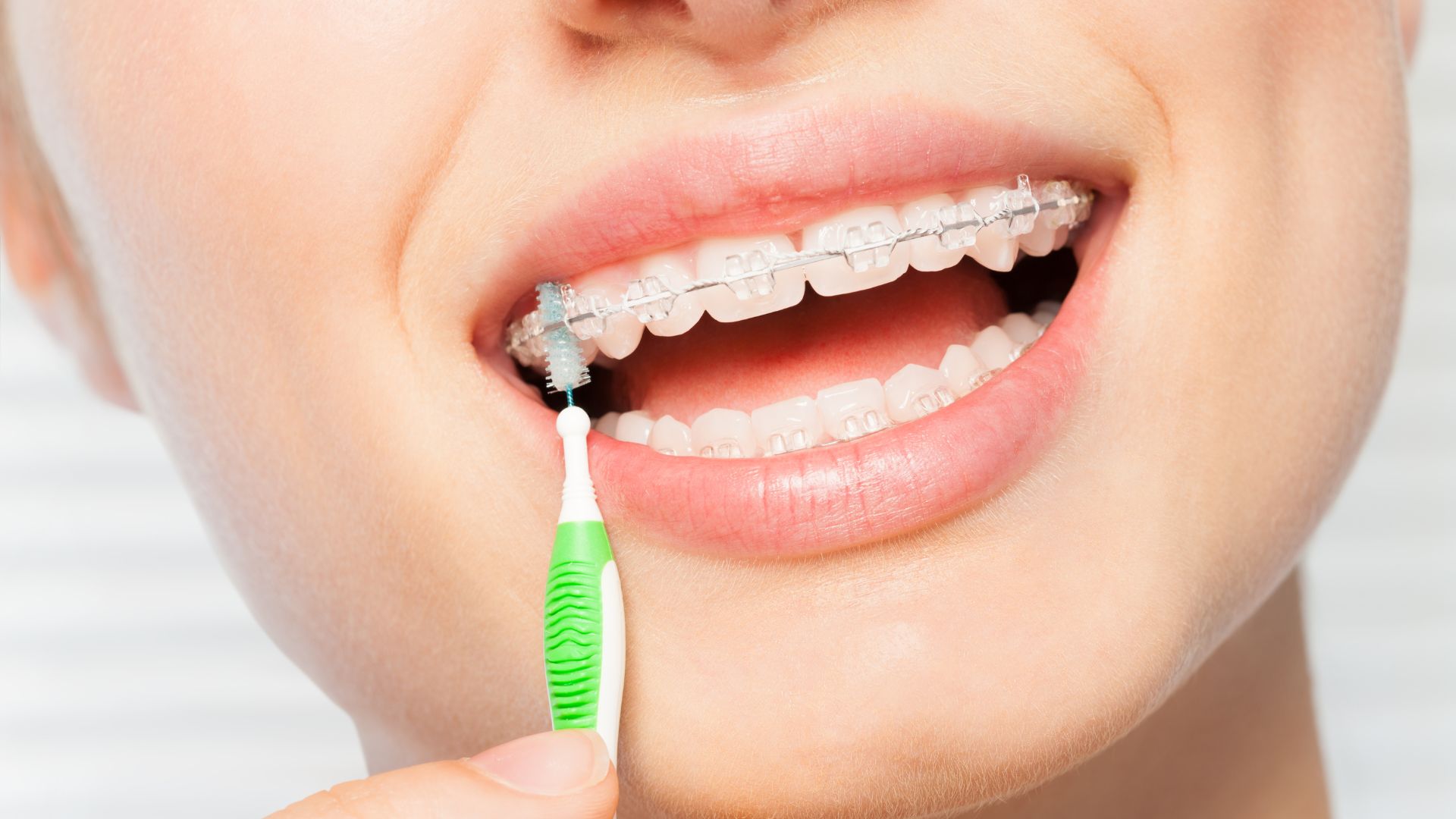 Scovolino per i denti: guida all'uso - Studio Buffelli