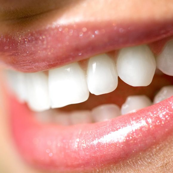 Protesi dentarie: la sostituzione di uno o più denti mancanti con protesi dentarie parziali o complete