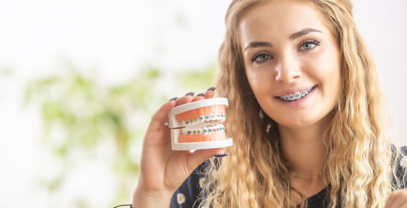 Guida ai diversi tipi di apparecchi dentali e loro funzioni