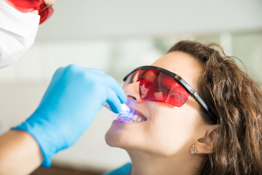 Sbiancamento dei Denti: Metodi, Sicurezza e Considerazioni