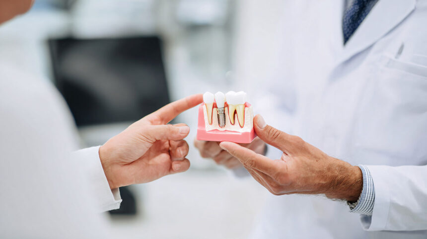 Impianto dentale o ponte: quale soluzione scegliere? Impianto dentale o ponte: quale soluzione scegliere?